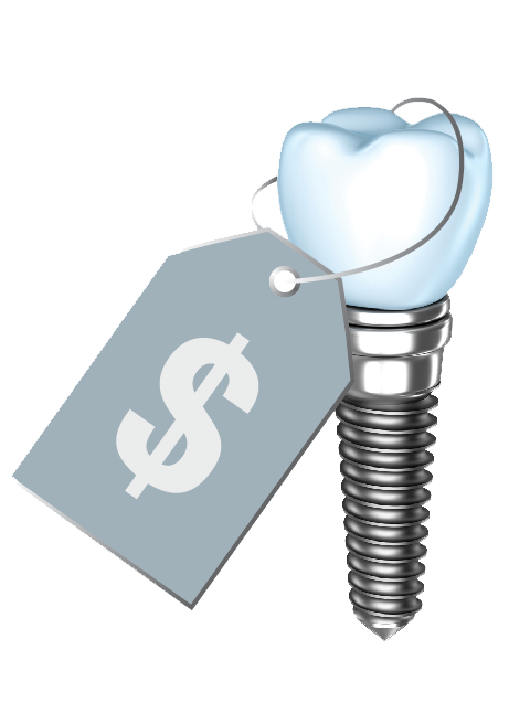 Why do Dental Implants cost so much